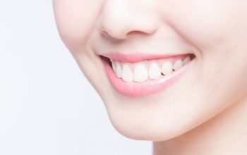 Buat Gigi Anda Lebih Putih dengan 5 Cara Sederhana Berikut